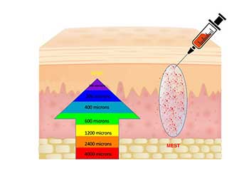 A New Classification for Adipose-derived Stromal-cell Systems